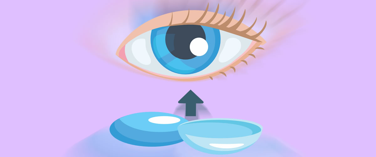 Tudo o que você queria saber sobre lentes de contato